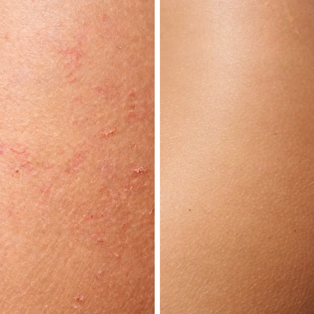 Neuroskin-Starter-Bundle mit gratis Aktivierungsöl