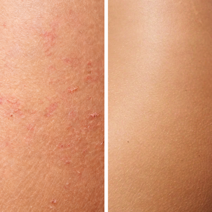 Neuroskin-Starter-Bundle mit gratis Aktivierungsöl